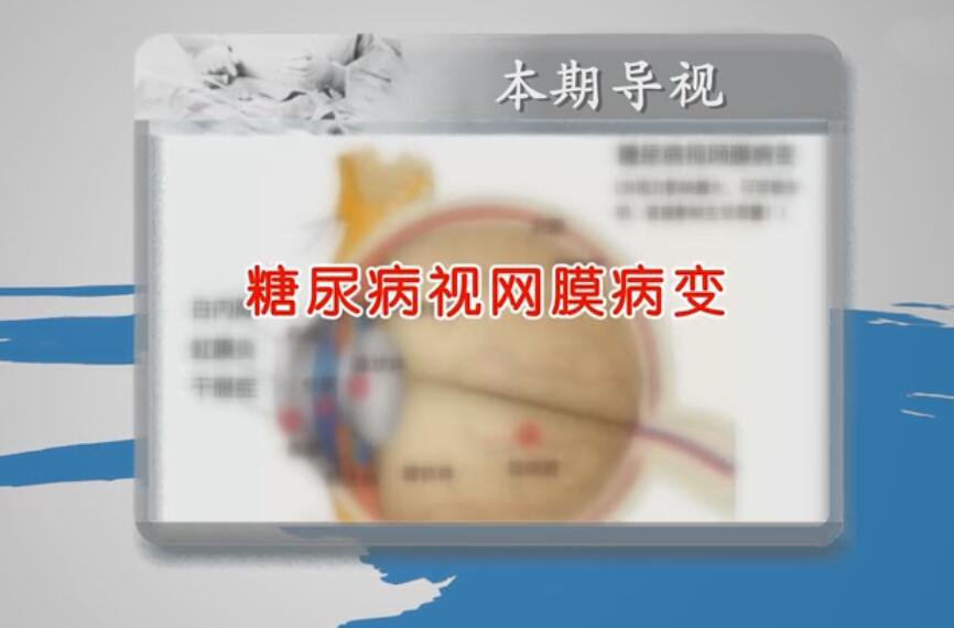 河南医聊谈谈糖尿病视网膜病变