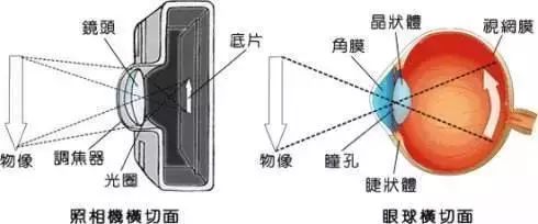 得了白内障该如何选择适合自己的晶体