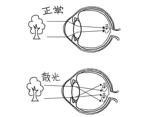 散光的世界是什么样子